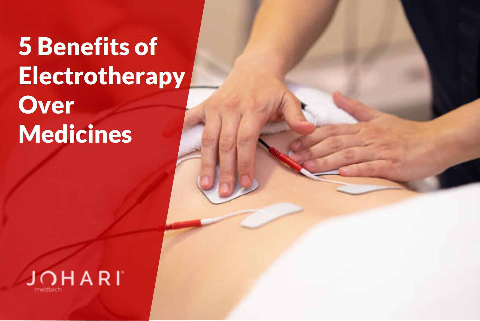 Benefits of Electrotherapy